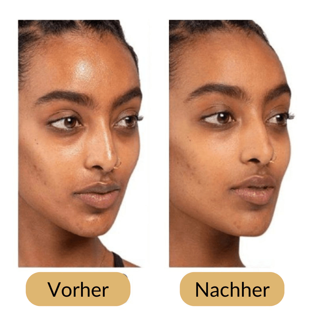 Lively® Cosmetics & Care Volcanic Roller for Matte Skin | Lively®